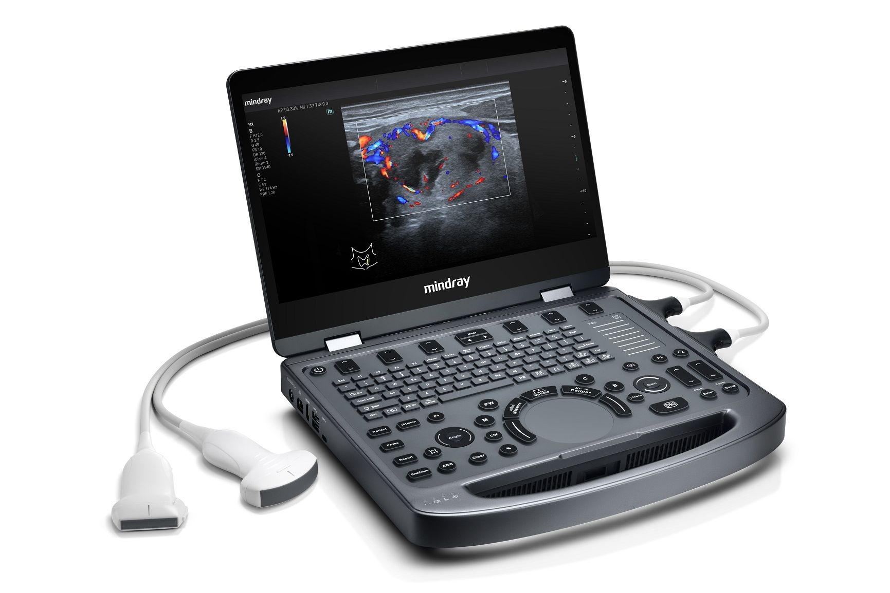 Mindray MX3